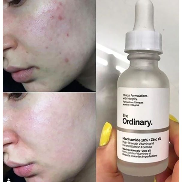 Niacinamida (60 ml)